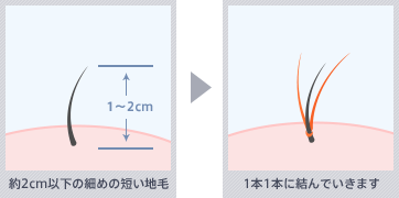 ステルス増毛