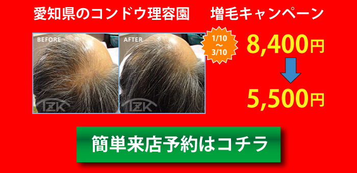 愛知県のコンドウ理容園 増毛キャンペーン
